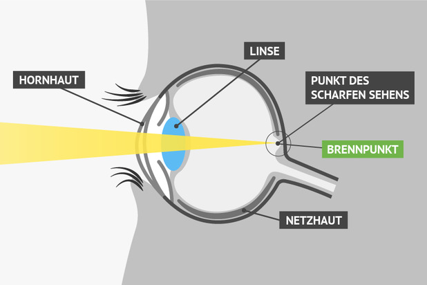 Sehschärfe (Visus) & Fehlsichtigkeiten